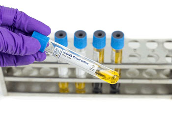 Cell Preservation